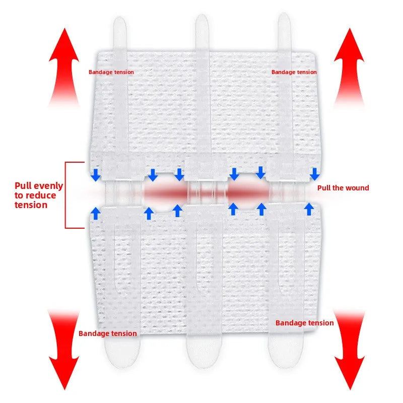 Self-Adhesive Personal Health Care Suture