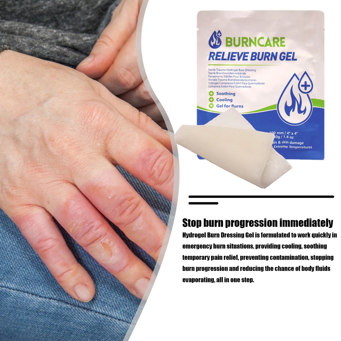 Emergency Burn Care Hydrogel First Aid