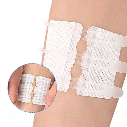 Self-Adhesive Personal Health Care Suture